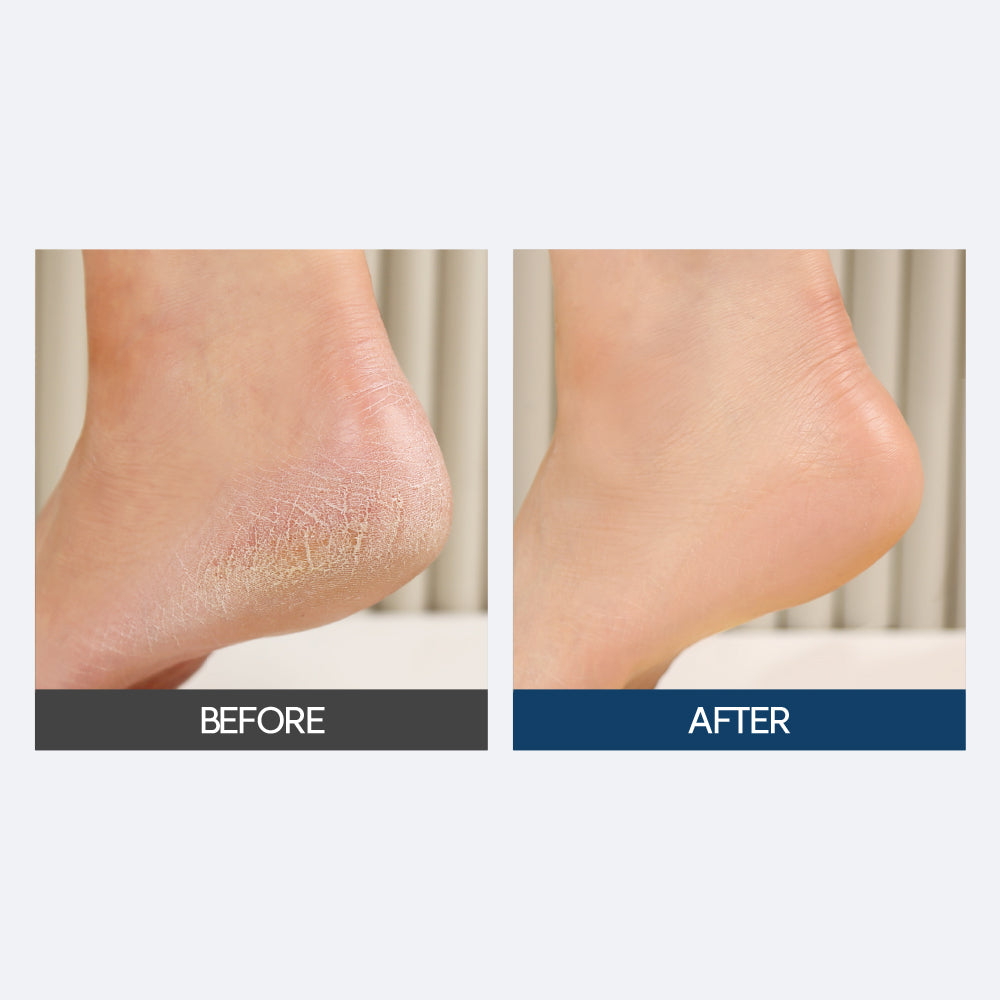 [F3] Milk Heal Peeling Mask