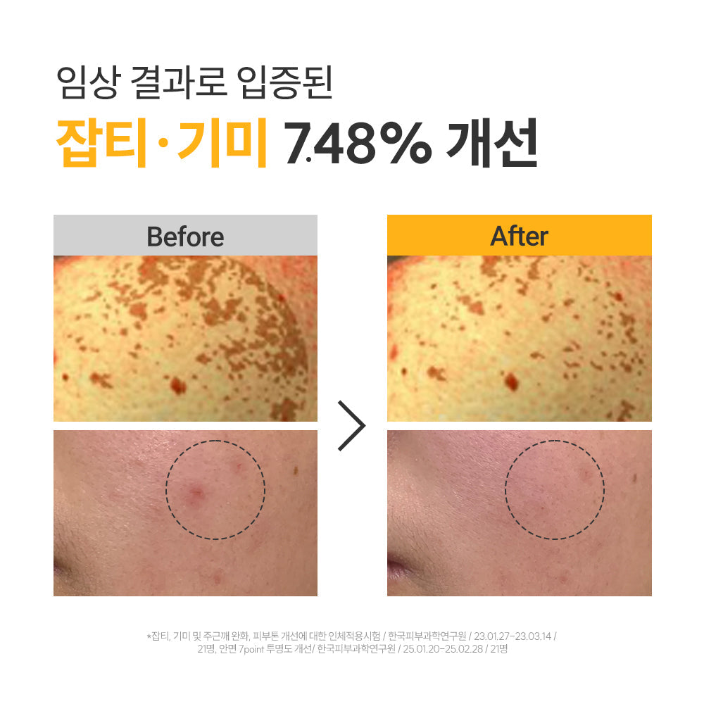 [rovectin] Rovectin Vita Dark Spot Serum 30ml