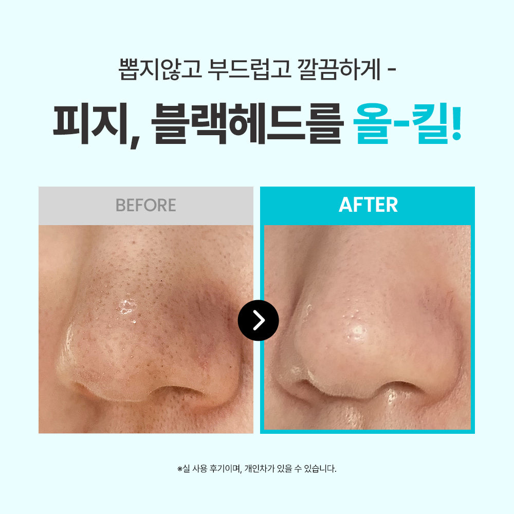 [Ilso] Ilso Super Melting Sebum Softener 150g special (+40 sticky cotton sheets + 1 pore pack)