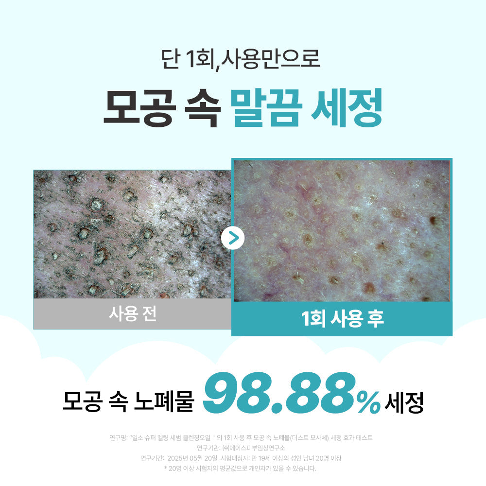 [Ilso] Ilso Super Melting Sebum Cleansing Oil 200ml Special (+Scrunch)