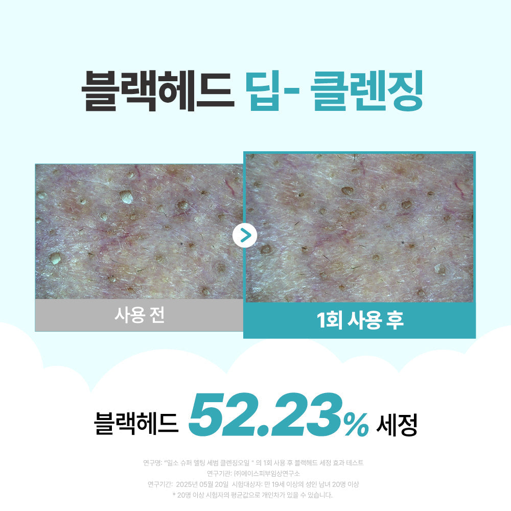 [Ilso] Ilso Super Melting Sebum Cleansing Oil 200ml Special (+Scrunch)