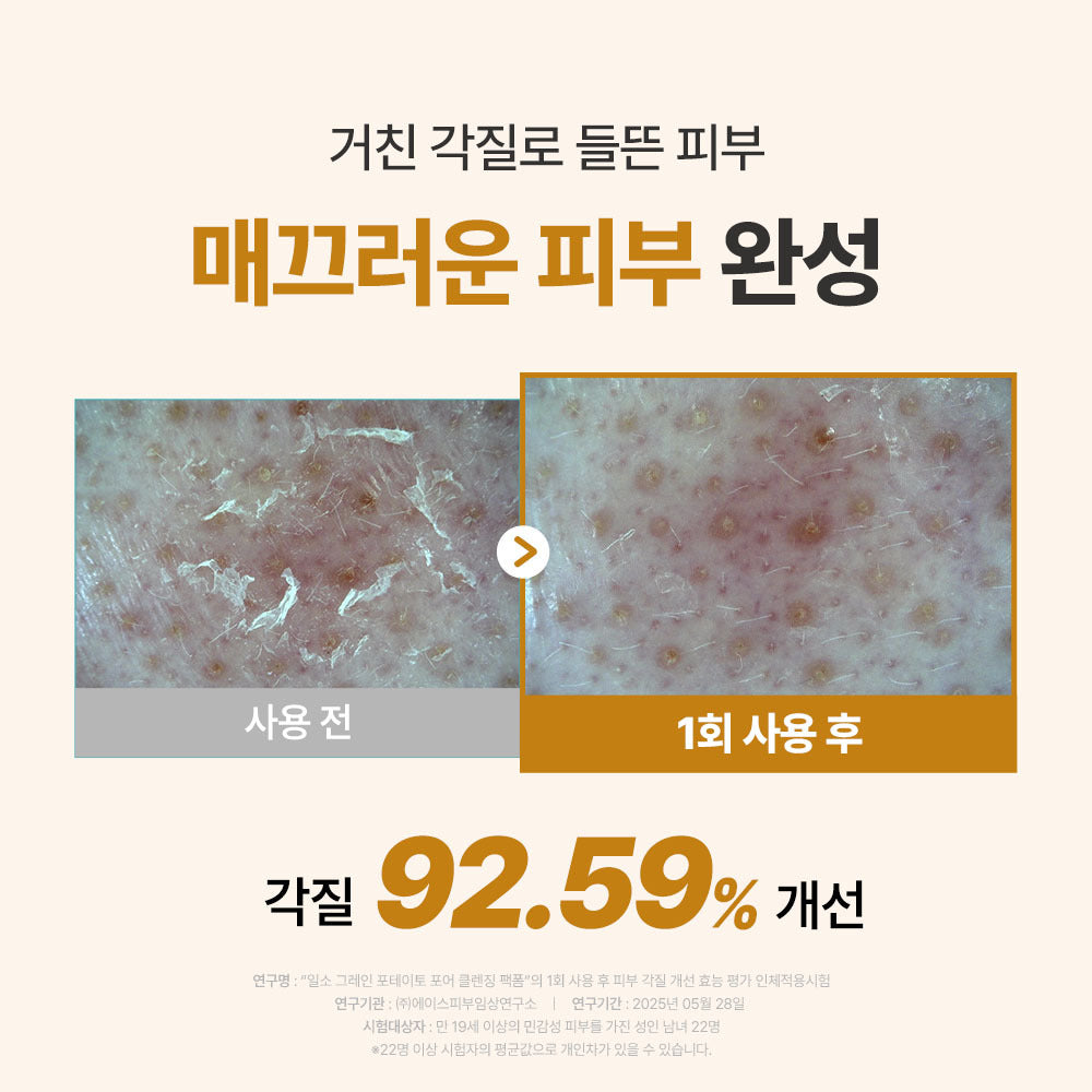 [Ilso] Ilso Grain Potato Cleansing Pack Foam 150ml Special (+Hairband)