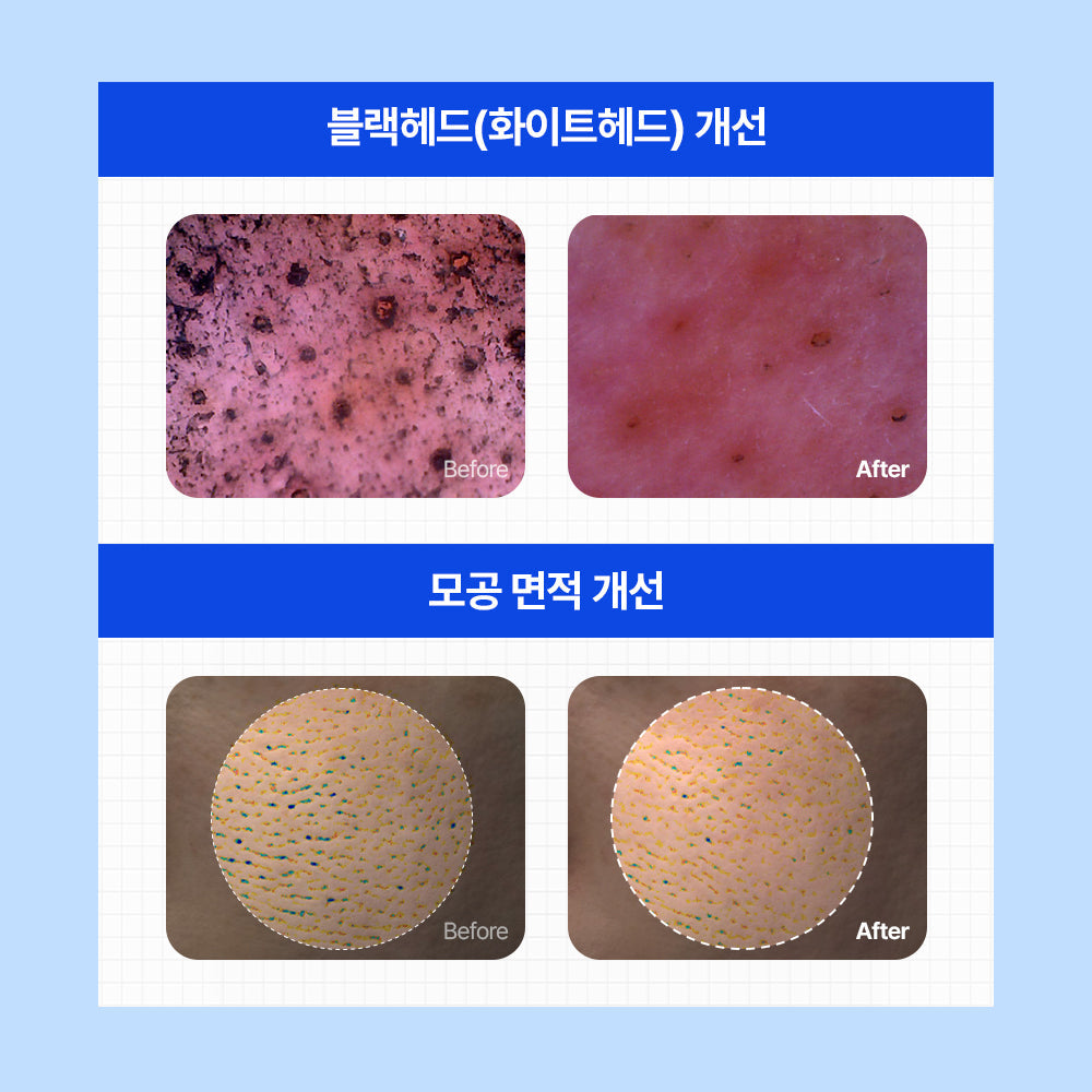 [Nature Republic] Blue Aloe Calming Pore Pad + Kit d'essai de produit gratuit