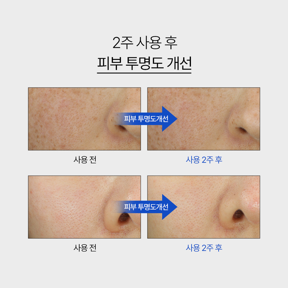 [Nature Republic] Hyatenol Hydra Toner (whitening function)